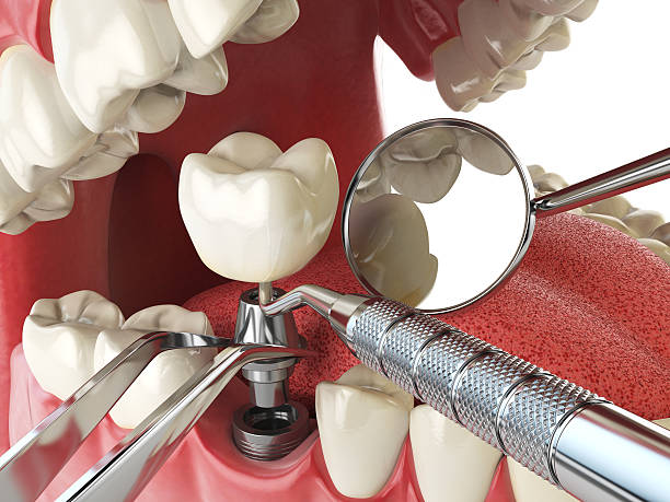 Best Urgent Tooth Repair  in East Mountain, TX